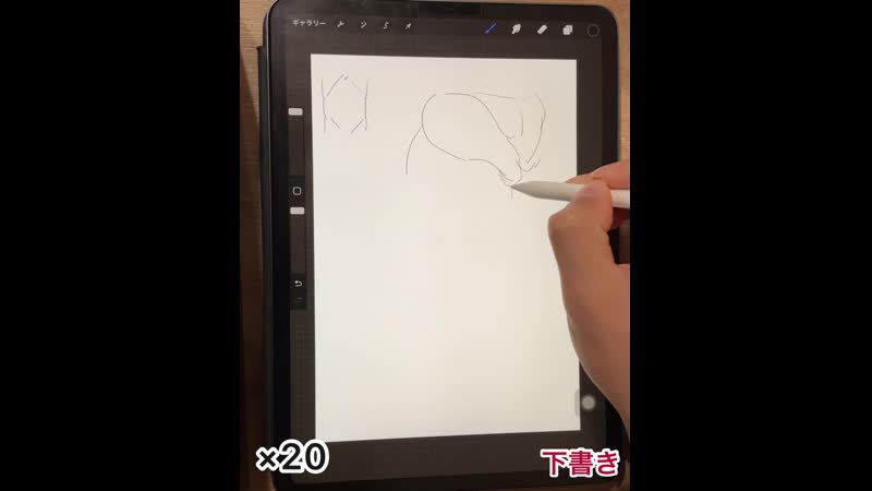 第14回　手術記録